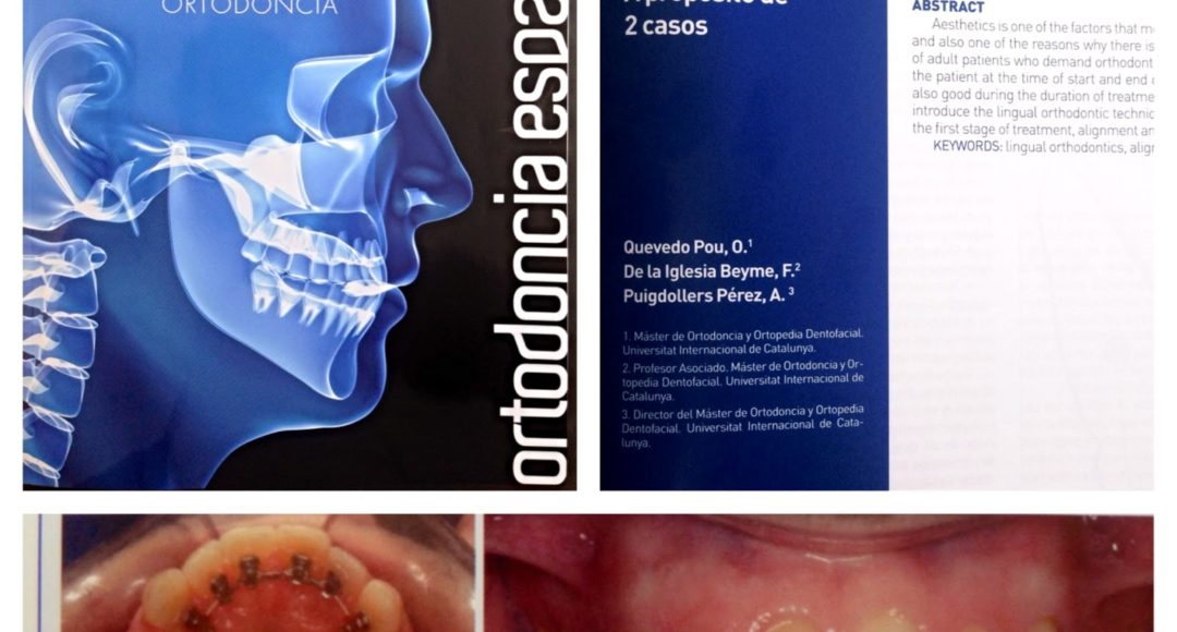 Foto 1 del artículo del Doctor Fernando de la Iglesia sobre Artículo Publicado en la Revista de la Sociedad Española de Ortodoncia