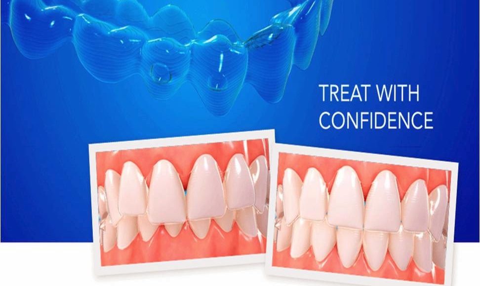 Foto 1 del artículo del Doctor Oriol Quevedo sobre Últimas novedades en Invisalign® 2014