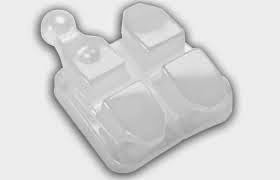 Foto 1 del artículo del Doctor Fernando de la Iglesia sobre Mitos y Verdades de Invisalign