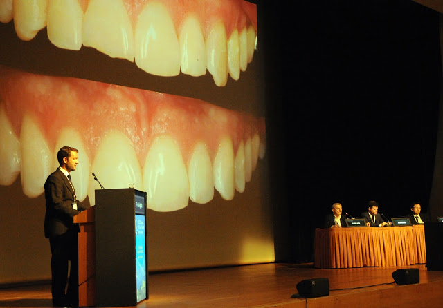 Foto 1 del artículo del Doctor Fernando de la Iglesia sobre Comunicación en el Congreso Europeo de Ortodoncia Lingual (Atenas 2016)