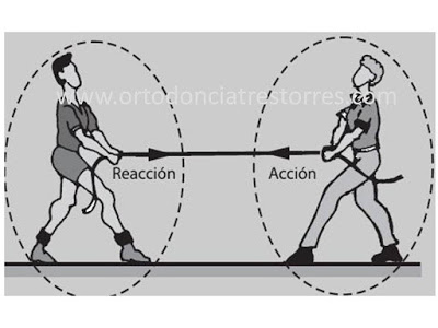 Foto 1 del artículo del Doctor Fernando de la Iglesia sobre Utilidad de los Microtornillos en Ortodoncia