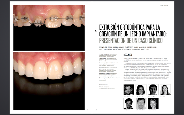 Foto 1 del artículo del Doctor Fernando de la Iglesia sobre publicación Artículo en la revista Periodoncia Clínica