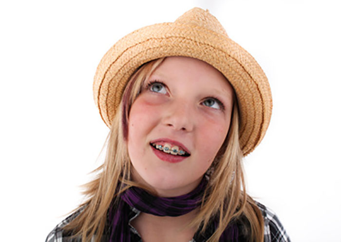 Caries durante la ortodoncia