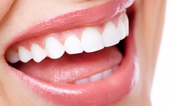 Imagen de una sonrisa después de aplicar la técnica de stripping dental después del tratamiento de ortodoncia