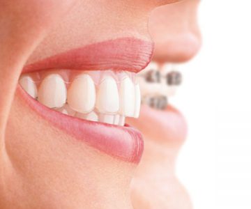  Técnicas para mejorar la higiene bucodental con ortodoncia