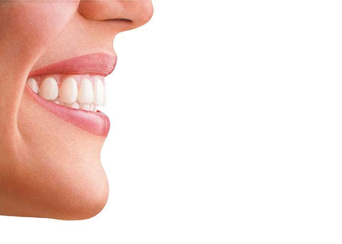 Imagen ortodoncia invisalign para introducir post Cómo actúa Invisalign en casos difíciles