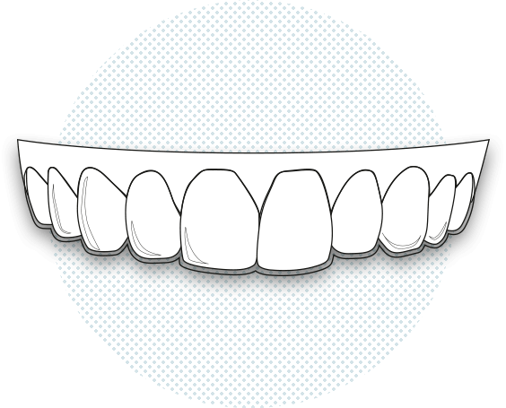 Ortodoncia Invisalign Barcelona