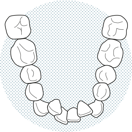 Apiñados dental Barcelona Apiñados dental Barcelona