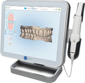 El tractament d’ortodòncia lingual s’inicia prenent digitalment impressions molt precises de les dents en 3D El tractament d'ortodòncia lingual s'inicia prenent digitalment impressions molt precises de les dents en 3D