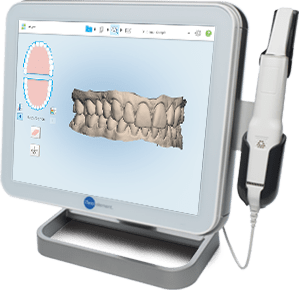 El tratamiento de ortodoncia lingual se inicia tomando digitalmente impresiones muy precisas de los dientes en 3D El tratamiento de ortodoncia lingual se inicia tomando digitalmente impresiones muy precisas de los dientes en 3D